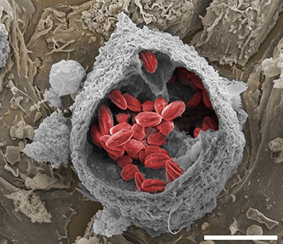 pv-aberto-varios-vacuolos