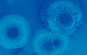 03_09_Microbiologia_Noticia_3_PNG